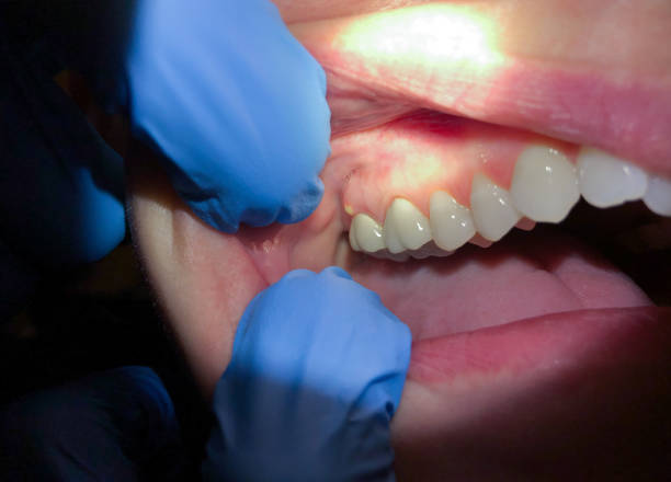 Best Pediatric Emergency Dentist in Falcon Heights, MN